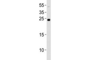 Western blot analysis of lysate from NCCIT cell line using LIN28A antibody at 1:1000. (LIN28A anticorps  (N-Term))