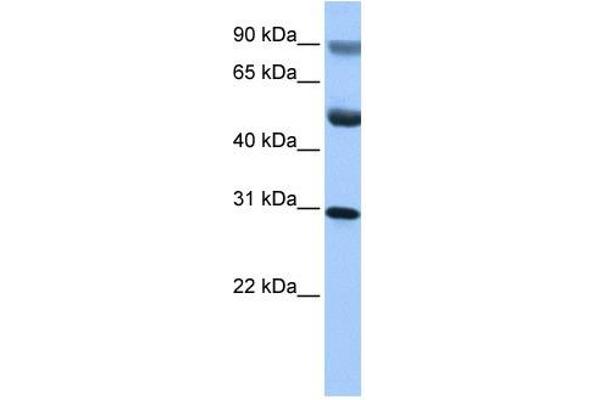 GID4 anticorps  (C-Term)