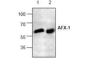 Image no. 1 for anti-Forkhead Box O4 (FOXO4) antibody (ABIN127087) (FOXO4 anticorps)