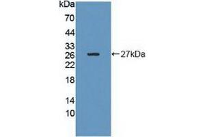 Detection of Recombinant Grb10, Human using Polyclonal Antibody to Growth Factor Receptor Bound Protein 10 (Grb10) (GRB10 anticorps  (AA 392-594))