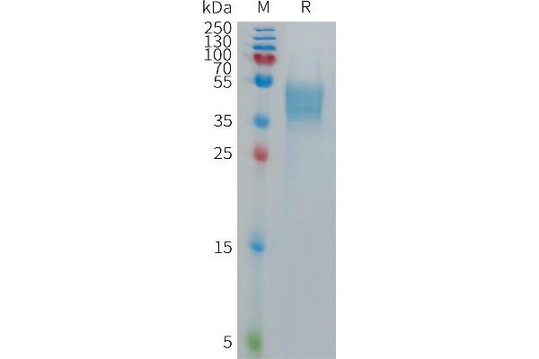 GPR75 Protein (AA 1-46) (mFc Tag)