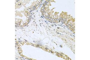 Immunohistochemistry of paraffin-embedded human prostate using BCR antibody (ABIN6003491) at dilution of 1/100 (40x lens). (BCR anticorps)