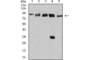 Western Blotting (WB) image for anti-DEAD (Asp-Glu-Ala-Asp) Box Polypeptide 1 (DDX1) (AA 642-740) antibody (ABIN5899136) (DDX1 anticorps  (AA 642-740))