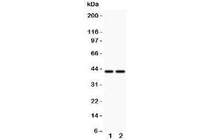 Western blot testing of CD244 antbody and  Lane 1: MCF-7;  2: HeLa (2B4 anticorps  (C-Term))