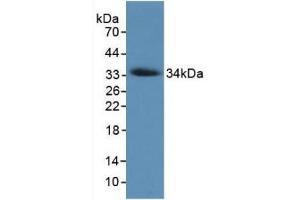 Detection of Recombinant COL7, Human using Monoclonal Antibody to Collagen Type VII (COL7) (COL7 anticorps  (AA 190-472))