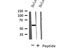 Western blot analysis on HeLa cells lysate using KLF4 antibody (KLF4 anticorps)