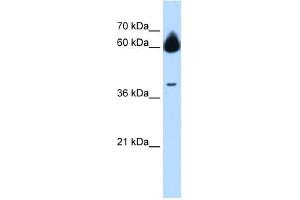 MMP23B antibody used at 1 ug/ml to detect target protein. (MMP23B anticorps  (N-Term))