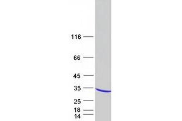 RAB30 Protein (Myc-DYKDDDDK Tag)