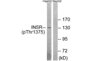 Western Blotting (WB) image for anti-IR (C-Term), (pThr1365), (pThr1375), (pThr1376) antibody (ABIN1847602) (IR (C-Term), (pThr1365), (pThr1375), (pThr1376) anticorps)