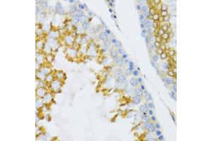 Immunohistochemistry of paraffin-embedded mouse testis using PTN Antibody. (Pleiotrophin anticorps)