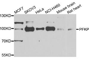 Western blot analysis of extracts of various cell lines, using PFKP antibody (ABIN5975671) at 1/1000 dilution. (PFKP anticorps)