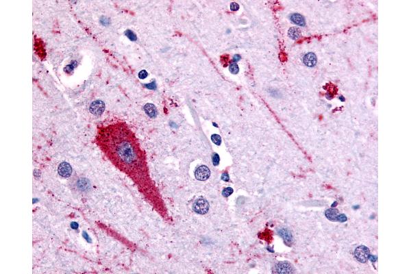 Serotonin Receptor 5A anticorps  (Extracellular Domain)