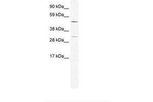 Image no. 1 for anti-Calcium/calmodulin-Dependent Protein Kinase IV (CAMK4) (AA 326-375) antibody (ABIN202605) (CAMK4 anticorps  (AA 326-375))