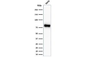 Western Blot Analysis of HeLa cell lysate using Beta-Catenin Recombinant Rabbit Monoclonal Antibody (CTNNB1/2030R). (Recombinant CTNNB1 anticorps)