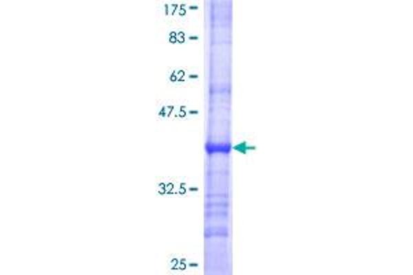 MCAT Protein (AA 291-390) (GST tag)