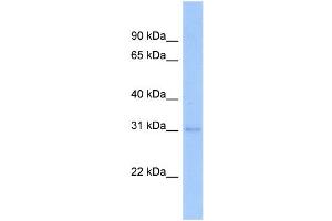 WB Suggested Anti-NFYB Antibody Titration:  0. (NFYB anticorps  (Middle Region))