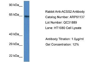 Western Blotting (WB) image for anti-Acyl-CoA Synthetase Short-Chain Family Member 2 (ACSS2) (N-Term) antibody (ABIN786342) (ACSS2 anticorps  (N-Term))