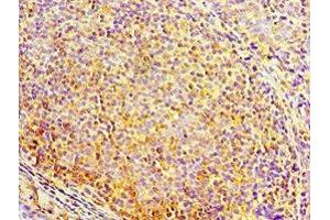 Immunohistochemistry of paraffin-embedded human tonsil tissue using ABIN7150705 at dilution of 1:100 (MAP2K3 anticorps  (AA 1-170))