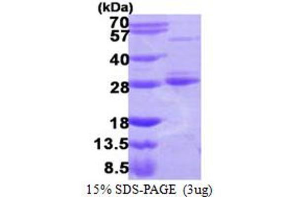 RAB17 Protein (AA 1-212) (His tag)