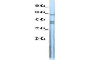 Western Blot showing CHRND antibody used at a concentration of 1-2 ug/ml to detect its target protein. (CHRND anticorps  (N-Term))