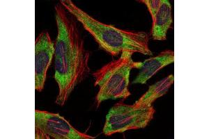 Immunofluorescence (IF) image for anti-Neurofilament, Light Polypeptide (NEFL) antibody (ABIN1108417) (NEFL anticorps)