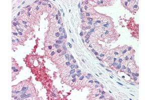 Anti-CADM2 antibody IHC of human prostate. (CADM2 anticorps  (Extracellular Domain))