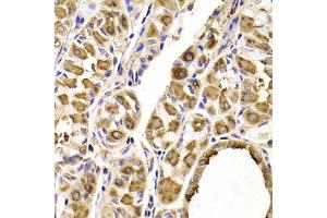 Immunohistochemistry of paraffin-embedded Human gastric using SEPT2 antibody at dilution of 1:100 (x400 lens). (Septin 2 anticorps)
