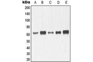 Western blot analysis of MMP14 expression in HeLa (A), HT1080 (B), MDMB23 (C), SP2/0 (D), mouse kidney (E), H9C2 (F) whole cell lysates. (MMP14 anticorps  (C-Term))