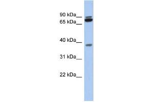 WB Suggested Anti-MGC70924 Antibody Titration: 0. (PRR19 anticorps  (Middle Region))