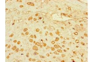 Immunohistochemistry of paraffin-embedded human placenta tissue using ABIN7143303 at dilution of 1:100 (Adenosine A2a Receptor anticorps  (AA 291-412))