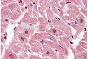 Human Heart (formalin-fixed, paraffin-embedded) stained with SIRT2 antibody ABIN461916 at 5 ug/ml followed by biotinylated goat anti-rabbit IgG secondary antibody ABIN481713, alkaline phosphatase-streptavidin and chromogen. (SIRT2 anticorps  (N-Term))