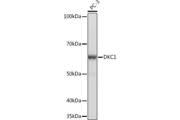 DKC1 anticorps