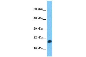 Western Blotting (WB) image for anti-Transcription Elongation Factor, Mitochondrial (TEFM) (N-Term) antibody (ABIN2506494) (TEFM anticorps  (N-Term))