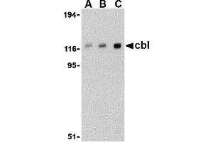 Western Blotting (WB) image for anti-Cas-Br-M (Murine) Ecotropic Retroviral Transforming Sequence (CBL) (C-Term) antibody (ABIN1030323) (CBL anticorps  (C-Term))