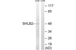 Western Blotting (WB) image for anti-SH3-Domain GRB2-Like Endophilin B2 (SH3GLB2) (Internal Region) antibody (ABIN1852154) (SH3GLB2 anticorps  (Internal Region))