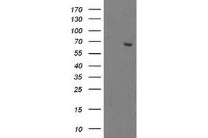 Western Blotting (WB) image for anti-2-Oxoglutarate and Iron-Dependent Oxygenase Domain Containing 1 (OGFOD1) antibody (ABIN1499911) (OGFOD1 anticorps)