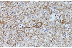 Immunohistochemistry of paraffin-embedded Mouse spinal cord using FKBP1B Polyclonal Antibody at dilution of 1:100 (40x lens). (FKBP1B anticorps)