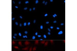 Immunofluorescence analysis of U2OS cells using PA2G4 Polyclonal Antibody (PA2G4 anticorps)