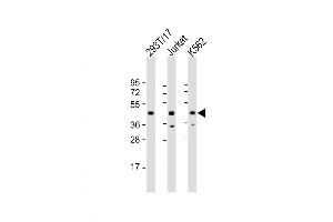 Western Blot at 1:2000 dilution Lane 1: 293T/17 whole cell lysate Lane 2: Jurkat whole cell lysate Lane 3: K562 whole cell lysate Lysates/proteins at 20 ug per lane. (PHF6 anticorps  (AA 148-180))