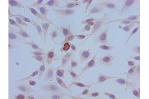 Immunocytochemistry analysis of Hela cells using ABIN7139614 at dilution of 1:100 (HIST1H3A anticorps  (pSer10))