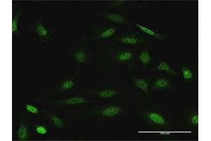 Immunofluorescence of purified MaxPab antibody to DUSP22 on HeLa cell. (DUSP22 anticorps  (AA 1-184))