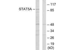 Western blot analysis of extracts from 293 cells, using STAT5A antibody. (STAT5A anticorps  (Internal Region))