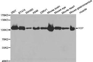 Western blot analysis of extracts of various cell lines, using VCP antibody (ABIN5971478) at 1:300 dilution. (VCP anticorps)