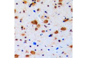 Immunohistochemical analysis of Topoisomerase 3 beta1 staining in human brain formalin fixed paraffin embedded tissue section. (Topoisomerase 3 Beta1 (N-Term) anticorps)
