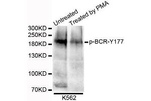 Western blot analysis of extracts of K562 cells, using Phospho-BCR-Y177 antibody. (BCR anticorps  (pTyr177))