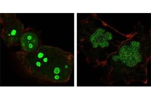 Confocal immunofluorescence analysis of Hela (left) and NTERA-2 (right) cells using NPM antibody (green). (NPM1 anticorps)