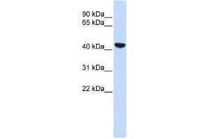 Cytokeratin 19 antibody used at 1 ug/ml to detect target protein. (Cytokeratin 19 anticorps  (N-Term))