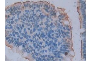 DAB staining on IHC-P; Samples: Rat Small intestine Tissue (ACE2 anticorps  (AA 392-739))