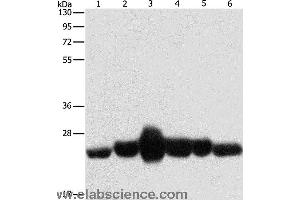Western blot analysis of Human fetal muscle and fetal lung tissue, Human leiomyosarcoma tissue, mouse lung and heart tissue,  NIH/3T3 cell, using CAV1 Polyclonal Antibody at dilution of 1:550 (Caveolin-1 anticorps)