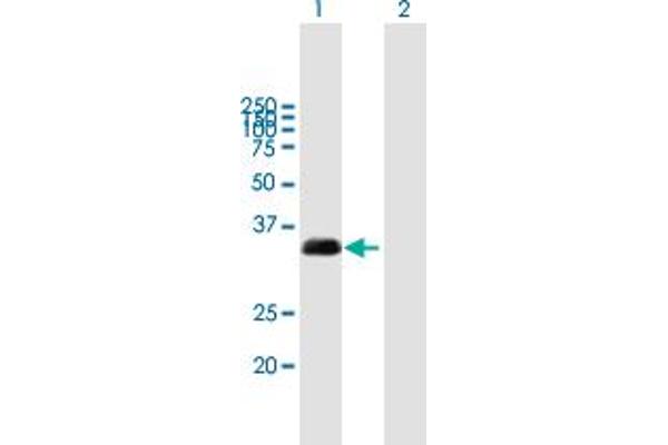 TMX1 anticorps  (AA 1-280)